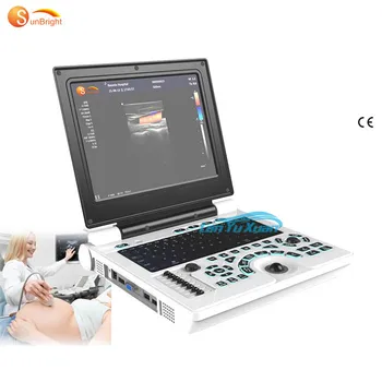 Spodbujanje Trajne prenosni ultrazvok scan stroj, barvni doppler dobro ceno